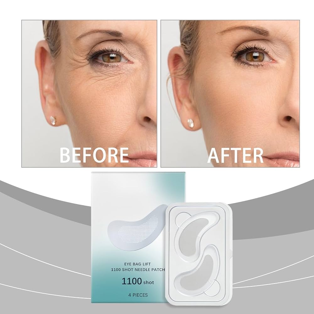 2X1/ Parches de Microagujas + Ácido hialurónico para ojeras, bolsas y arrugas