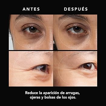 2X1/ Parches de Microagujas + Ácido hialurónico para ojeras, bolsas y arrugas