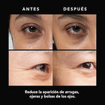 2X1/ Parches de Microagujas + Ácido hialurónico para ojeras, bolsas y arrugas