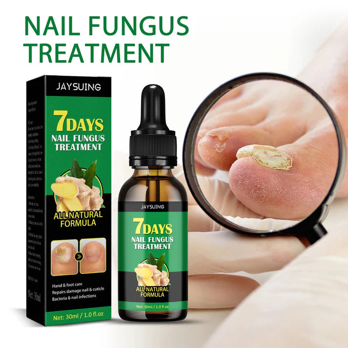 FUNGUS FREE NAILS® DILE ADIOS A LOS HONGOS , RECUPERA LA BELLEZA Y SALUD DE TUS UÑAS