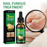FUNGUS FREE NAILS® DILE ADIOS A LOS HONGOS , RECUPERA LA BELLEZA Y SALUD DE TUS UÑAS